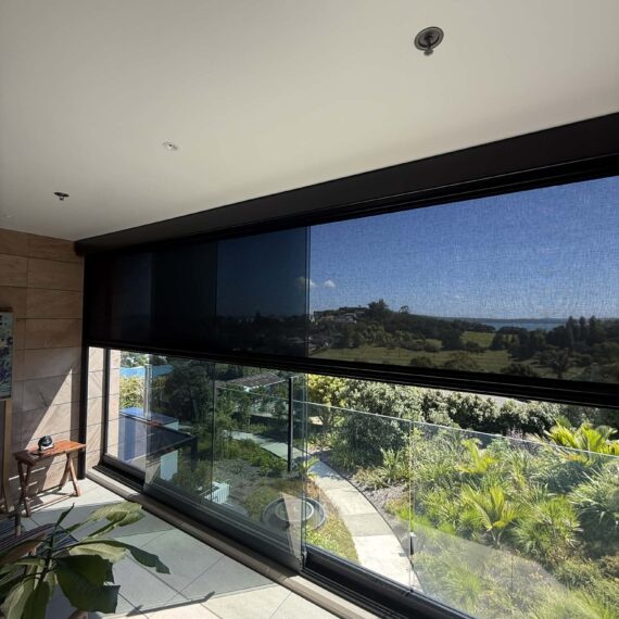 Motorised Ziptrak Screen in St Heliers